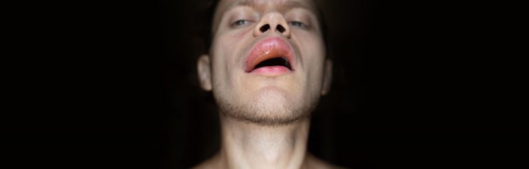 A man's face with very swollen lips, against a black background.